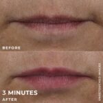 RoC Derm Correxion Lip Volumizer 10 ml - Imagen 4