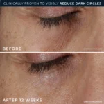 RoC Derm Correxion Eye Repair Dark Circle Cream 15ml - Imagen 4