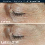 RoC Derm Correxion Dual Eye Cream - Imagen 3