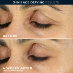 ROC Retinol Correxion Line Smoothing Eye Cream 15ml - Imagen 2