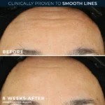 RoC Retinol Correxion Line Smoothing Night Serum Capsulas - Imagen 4