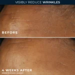 RoC Retinol Correxion Wrinkle Correct Daily Moisturiser SPF30 - Imagen 2
