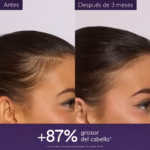 Caudalie Sérum Capilar Anticaída 50ml - Imagen 4