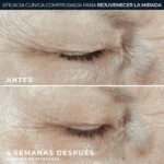 Roc Hydra + Hyaluronic Contorno de Ojos 15ml - Imagen 3